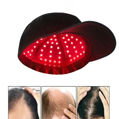 🧢✨ Rödljus Hårväxtkeps || Ger Starkare Hår – Stimulerar Hårväxt & Mindre Håravfall
