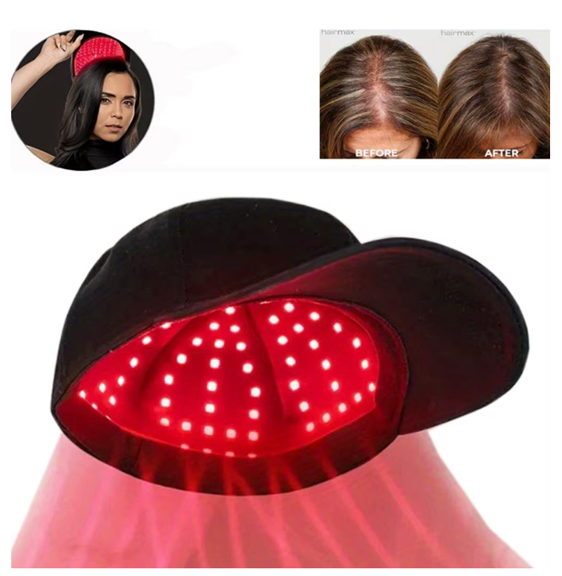 🧢✨ Rödljus Hårväxtkeps || Ger Starkare Hår – Stimulerar Hårväxt & Mindre Håravfall